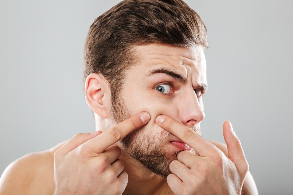 What Is Excoriation Disorder? Stop Compulsive Skin Picking!