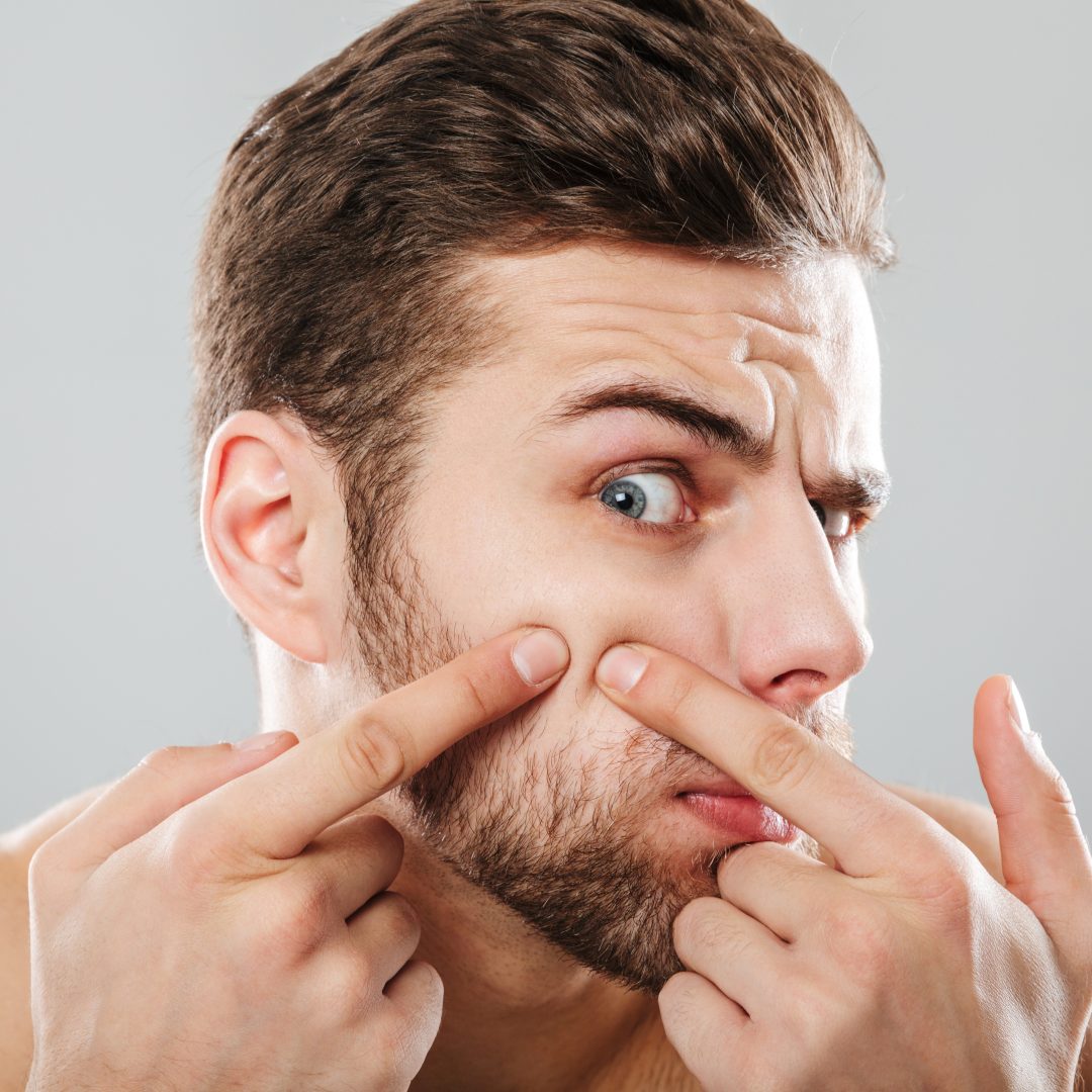 Man with skin picking disorder